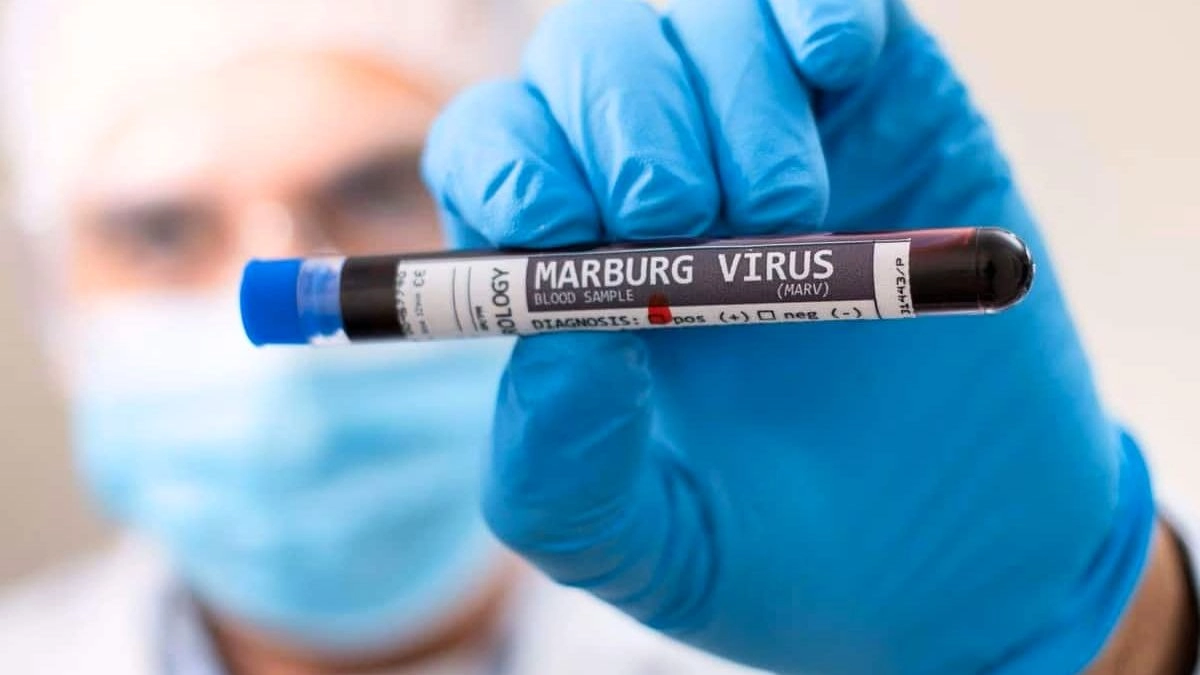 UAE Issues Travel Warning Over Marburg Virus